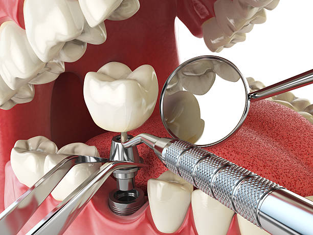 Best Emergency Dental Care for Broken or Chipped Teeth in Lightstreet, PA